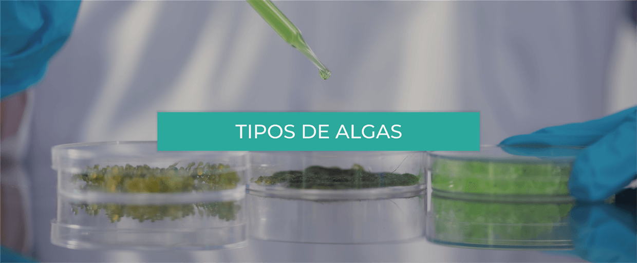 Tipos de algas